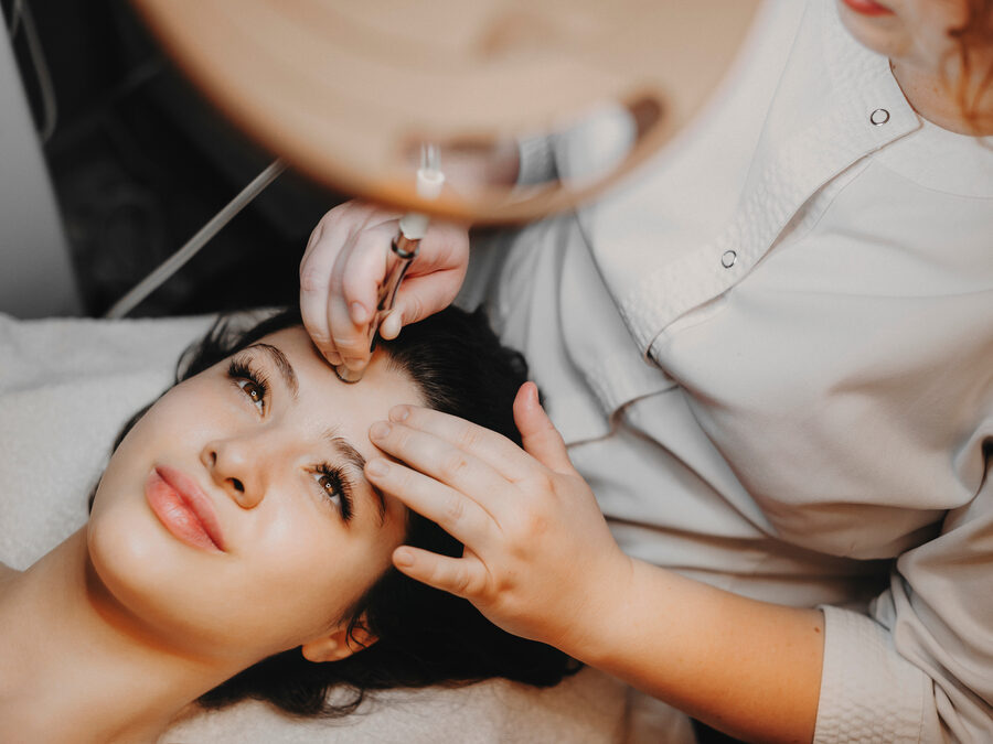 Microneedling