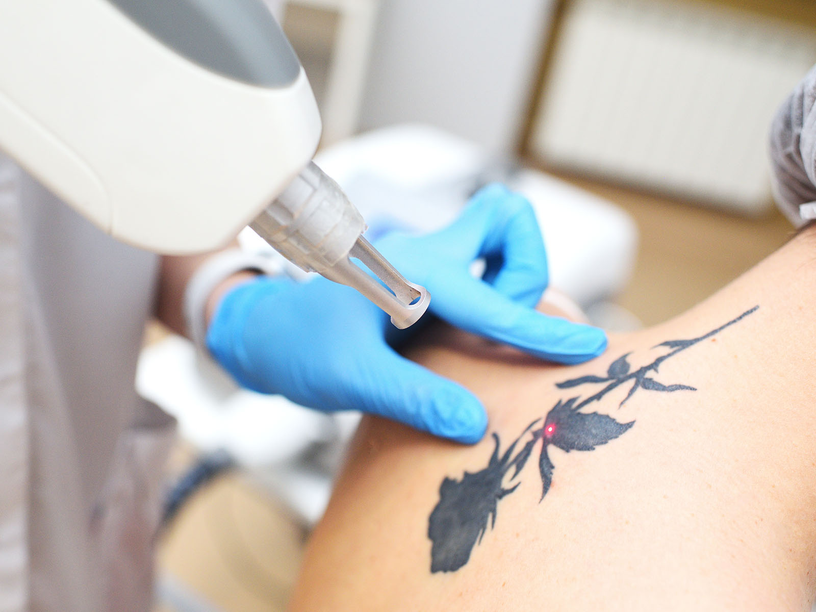 Laser & Tattoo Removal